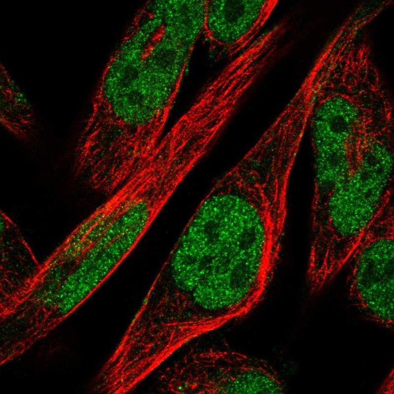 Anti-ZNF594 Antibody