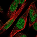 Anti-ZNF594 Antibody