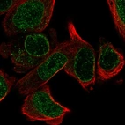 Immunofluorescent staining of human cell line PC-3 shows localization to nucleoplasm, nuclear membrane & vesicles.