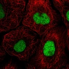 Immunofluorescent staining of human cell line HaCaT shows localization to nucleus.