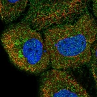 Immunofluorescent staining of human cell line HaCaT shows localization to plasma membrane.