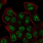 Anti-REV3L Antibody