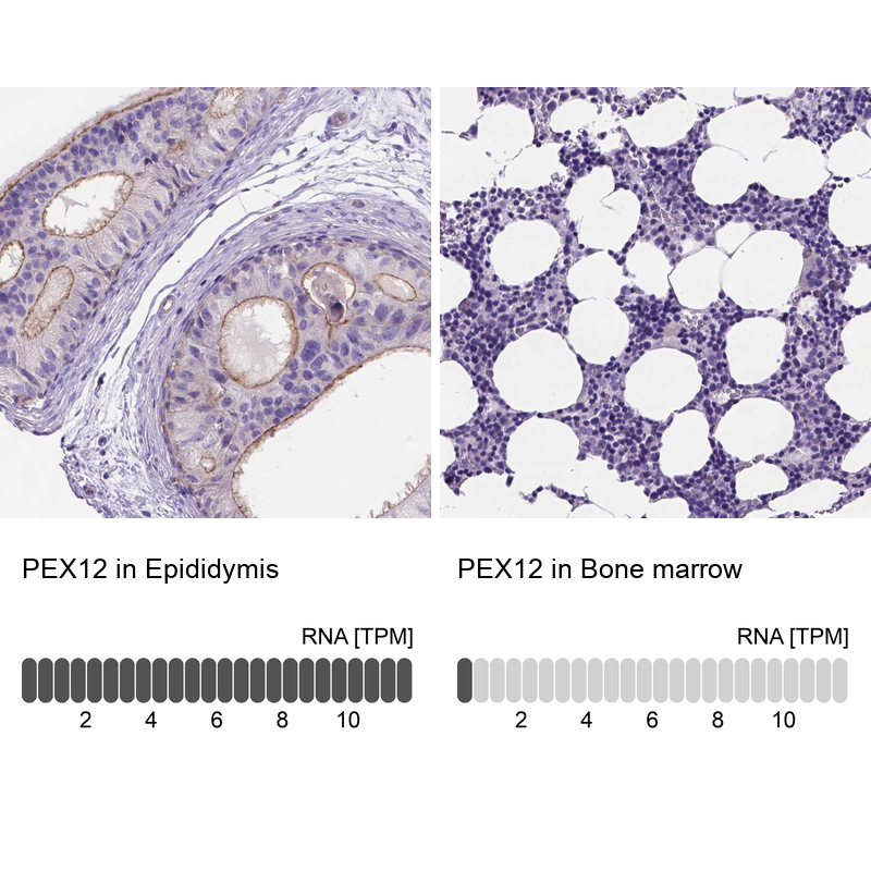 Anti-PEX12 Antibody
