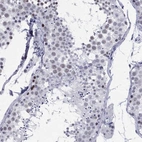 Immunohistochemical staining of human testis shows high expression.