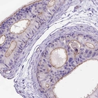 Immunohistochemical staining of human epididymis shows high expression.