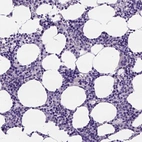Immunohistochemical staining of human bone marrow shows low expression as expected.