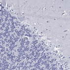 Anti-ASF1B Antibody