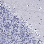 Immunohistochemical staining of human cerebellum shows low expression as expected.