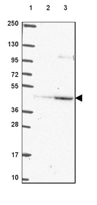 Lane 1: Marker [kDa] 250, 130, 95, 72, 55, 36, 28, 17, 10_br/_Lane 2: Human cell line RT-4_br/_Lane 3: Human cell line U-251 MG