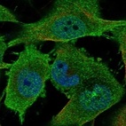 Anti-EPHA3 Antibody