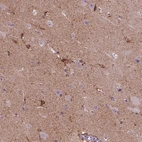 Immunohistochemical staining of human cerebral cortex shows strong cytoplasmic positivity in glial cells and neuropil.
