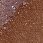 Immunohistochemical staining of human cerebellum shows strong cytoplasmic positivity in neuropil.