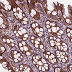 Immunohistochemical staining of human colon shows strong cytoplasmic positivity in glandular cells.