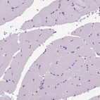 Immunohistochemical staining of human skeletal muscle shows no cytoplasmic positivity in myocytes as expected.