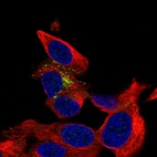 Anti-B3GAT1 Antibody