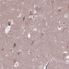 Anti-TMEM135 Antibody
