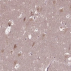 Anti-TMEM135 Antibody