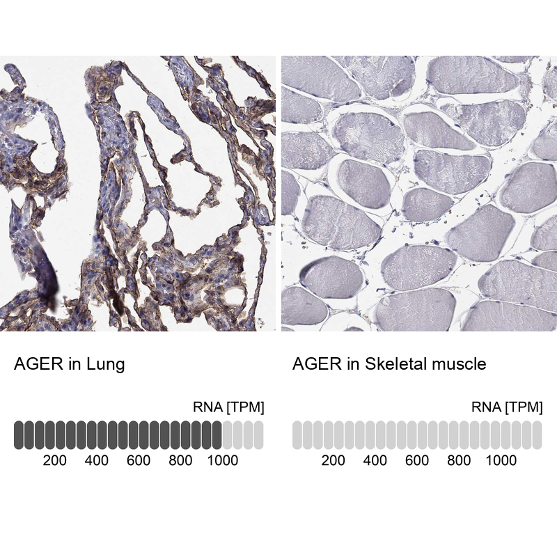 Anti-AGER Antibody