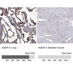 Anti-AGER Antibody