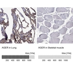 Anti-AGER Antibody