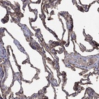 Immunohistochemical staining of human lung shows high expression.