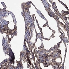 Immunohistochemical staining of human lung shows strong membranous positivity in pneumocytes.