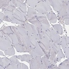 Immunohistochemical staining of human skeletal muscle shows low expression as expected.