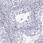 Immunohistochemical staining of human testis shows no positivity in cells in seminiferous ducts.