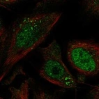 Anti-MCOLN1 Antibody