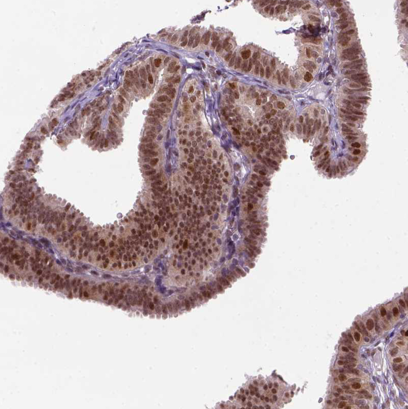 Anti-MGMT Antibody