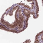 Anti-MGMT Antibody