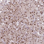Immunohistochemical staining of human liver shows moderate nuclear positivity in hepatocytes.