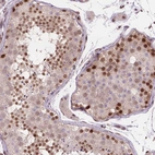 Immunohistochemical staining of human testis shows moderate nuclear positivity in cells in seminiferous ducts.
