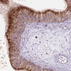Immunohistochemical staining of human epididymis shows strong granular cytoplasmic positivity in glandular cells.