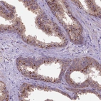 Immunohistochemical staining of human prostate shows strong granular cystoplasmic positivity in glandular cells.