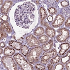 Immunohistochemical staining of human kidney shows strong granular cytoplasmic positivity in cells in tubules.