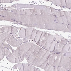 Immunohistochemical staining of human skeletal muscle shows no positivity in myocytes as expected.