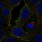 Anti-CCR3 Antibody