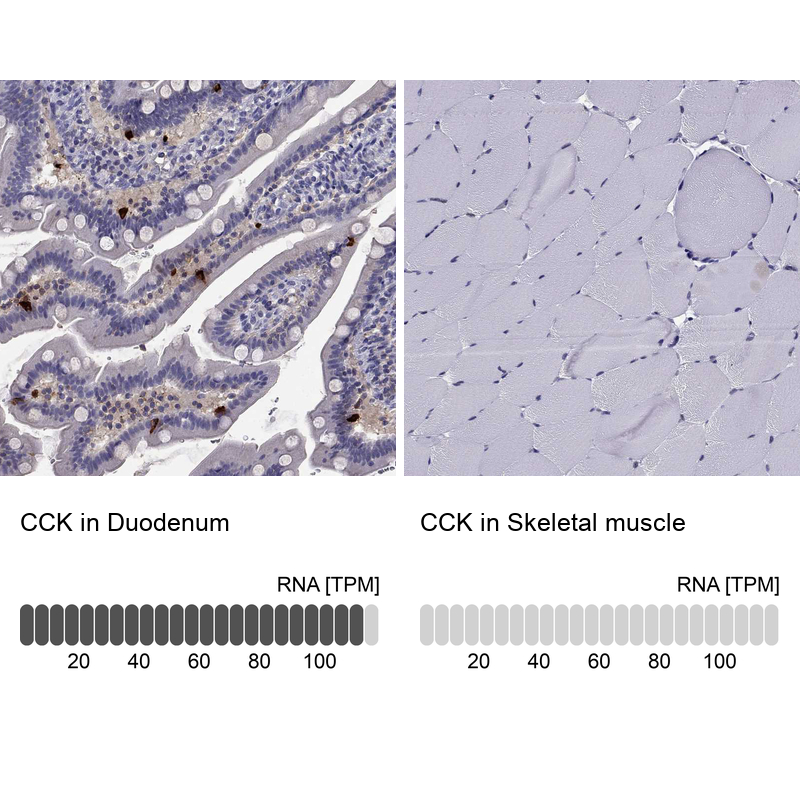 Anti-CCK Antibody