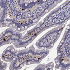 Immunohistochemical staining of human duodenum shows strong cytoplasmic positivity in endocrine glandular cells.