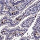 Immunohistochemical staining of human duodenum shows strong cytoplasmic positivity in endocrine glandular cells.
