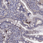 Immunohistochemical staining of human small intestine shows strong cytoplasmic positivity in endocrine glandular cells.