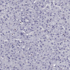 Immunohistochemical staining of human liver shows no positivity in hepatocytes as expected.
