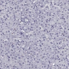 Immunohistochemical staining of human liver shows no positivity in hepatocytes as expected.