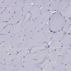 Immunohistochemical staining of human skeletal muscle shows no positivity in myocytes as expected.