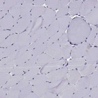 Immunohistochemical staining of human skeletal muscle shows no positivity in myocytes as expected.