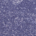 Immunohistochemical staining of human lymph node shows no positivity in non-germinal center cells as expected.