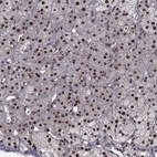 Anti-DMAP1 Antibody