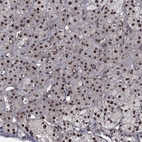 Anti-DMAP1 Antibody