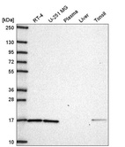 Western blot analysis in human cell line RT-4, human cell line U-251 MG, human plasma, human liver tissue and human tonsil tissue.